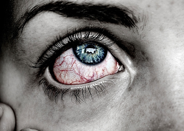 눈 질환 / pixabay