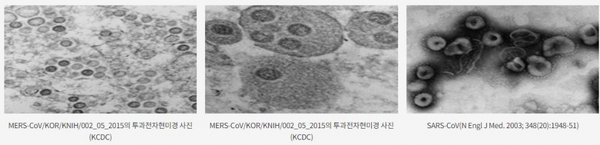 코로나바이러스 전자현미경 형태 / 질병관리본부 홈페이지