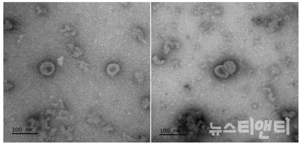 코로나19 바이러스항원(Spike)으로 구성된 바이러스유사체 투과전자현미경 (TEM) 이미지 / 보건복지부 제공