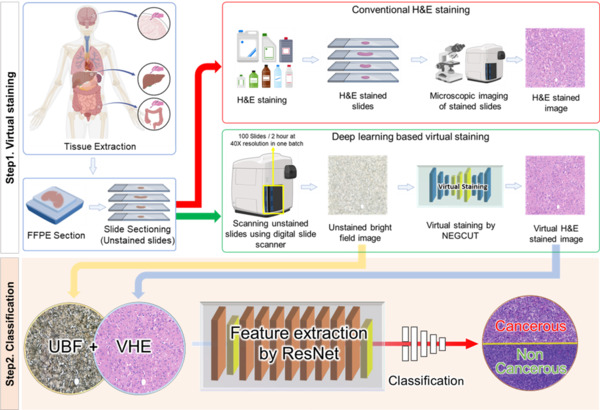 딥러닝 기반 가상H&E(VHE) 염색 및 암 분류 파이프라인 개요. 염색되지 않은 FFPE 명시야 영상을 디지털 슬라이드 스캐너로 고속 획득한 뒤, NEGCUT 모델을 통해 진단 품질의 가상 H&E 이미지(VHE)를 생성한다. 생성된 무염색(UBF) 영상과 VHE 영상은 이중 ResNet-18 인코더에서 통합 분석되어 암·비암 조직을 분류하며, 이를 통해 기존 H&E 염색을 대체할 수 있는 고처리량·비(非)염색 병리 진단이 가능해진다.